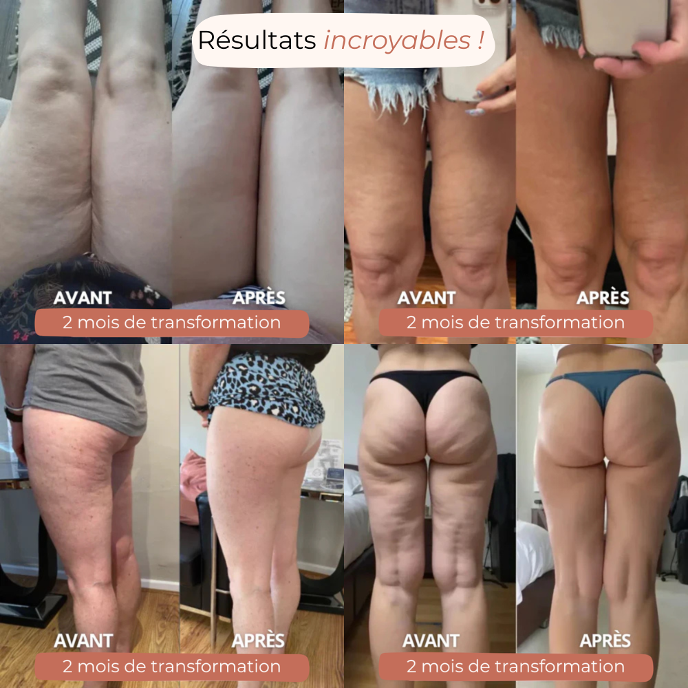 Legging 3D Anti-Cellulite