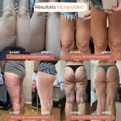 Legging 3D Anti-Cellulite